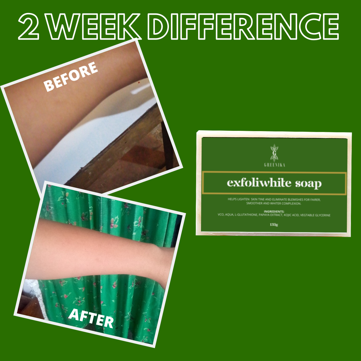 Greenika Exfolika Soap Lightens and Whitens Skin