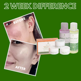 Greenika Brightening Skin Care Set Local Obagi Set