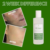 Greenika Oil Control Facial Wash
