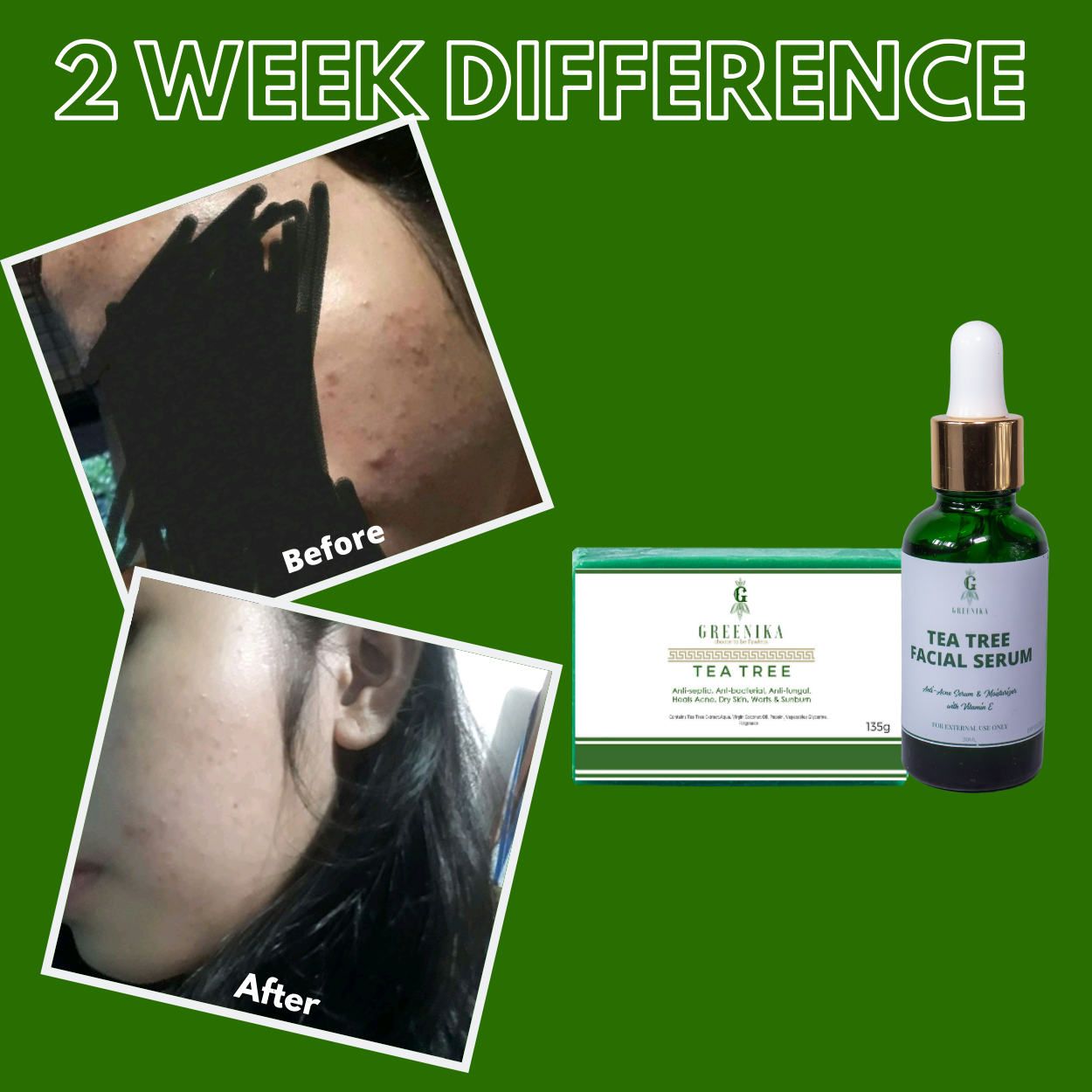 Greenika Tea Tree Combo Face Serum & Soap