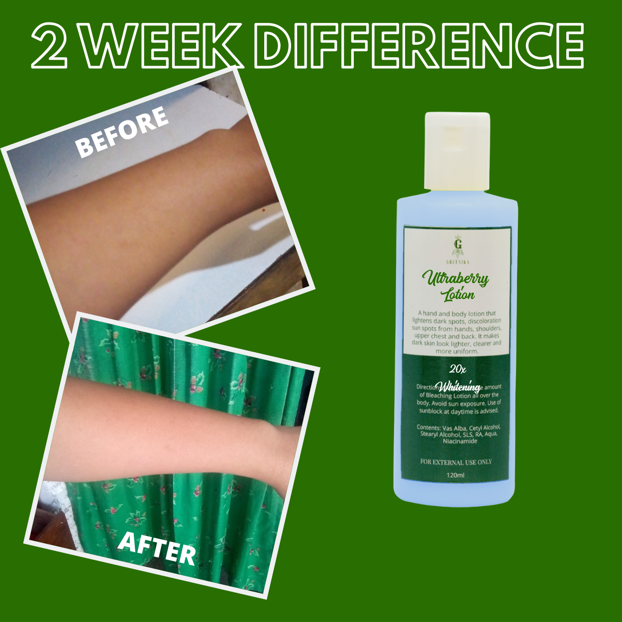 Greenika Ultraberry Whitening Lotion