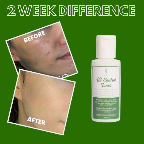 Greenika Oil Control Facial Toner