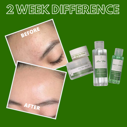 Greenika Aloe Vera Skin Care Set