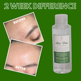 Greenika Aloe Vera Facial Toner Rich in Vitamin E