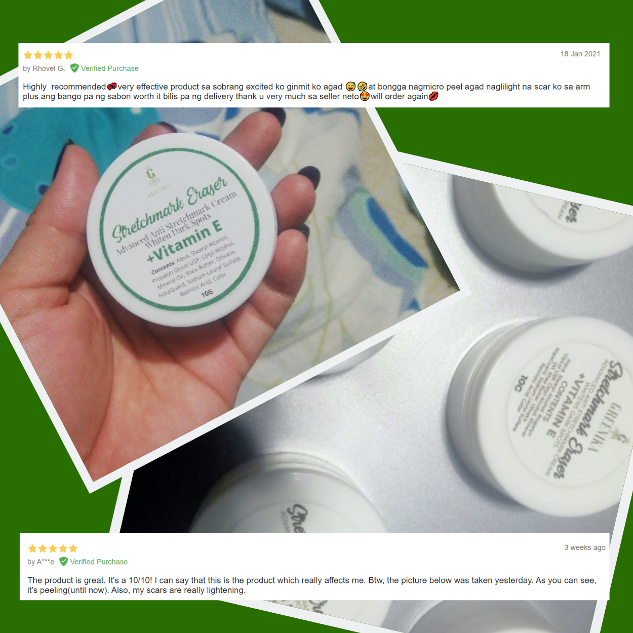 Greenika Stretch Mark Cream Dark Spot Remover
