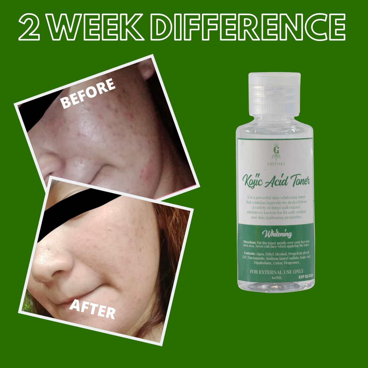 Greenika Kojic Acid Toner