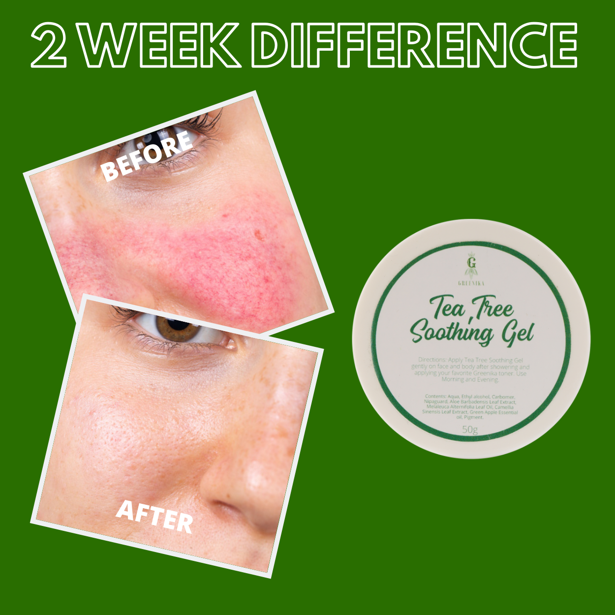 Greenika Tea Tree Gel with Aloe Vera Extract