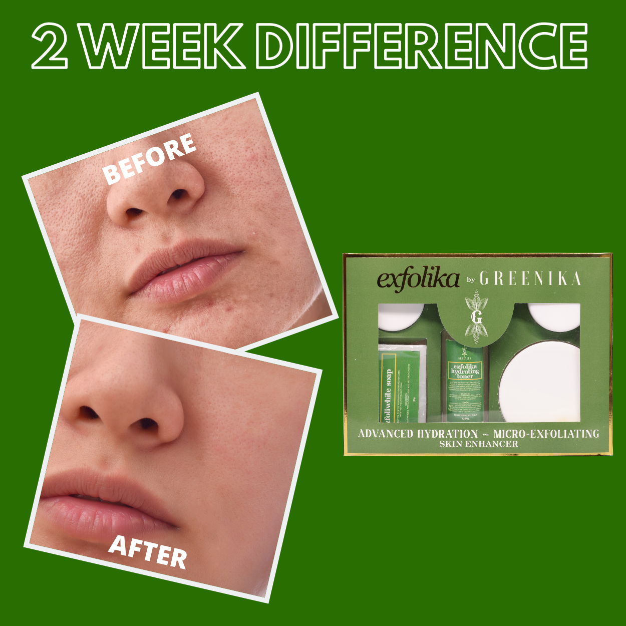 Greenika Exfolika Whitening Set
