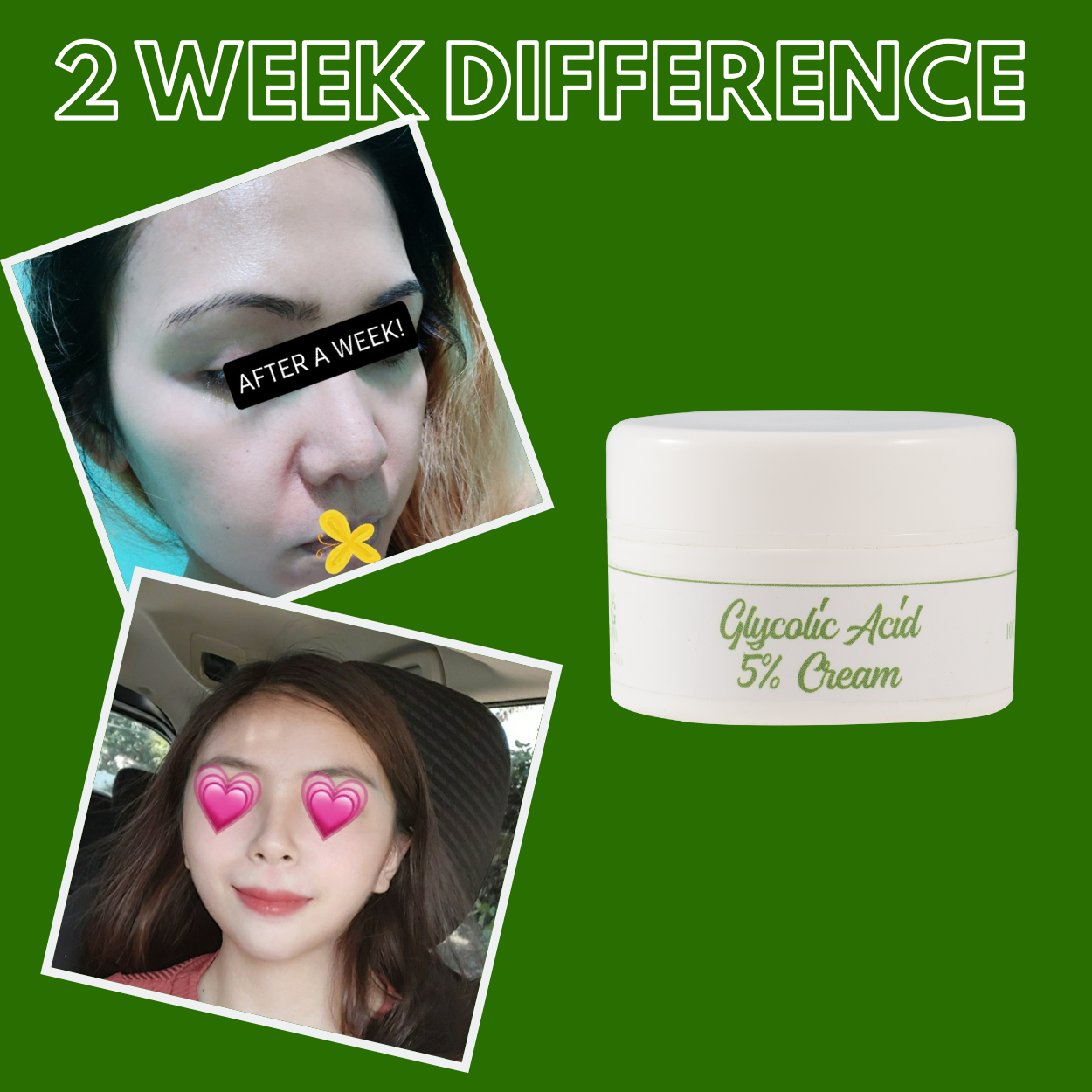 Greenika Glycolic Acid 5% Exfoliating Cream