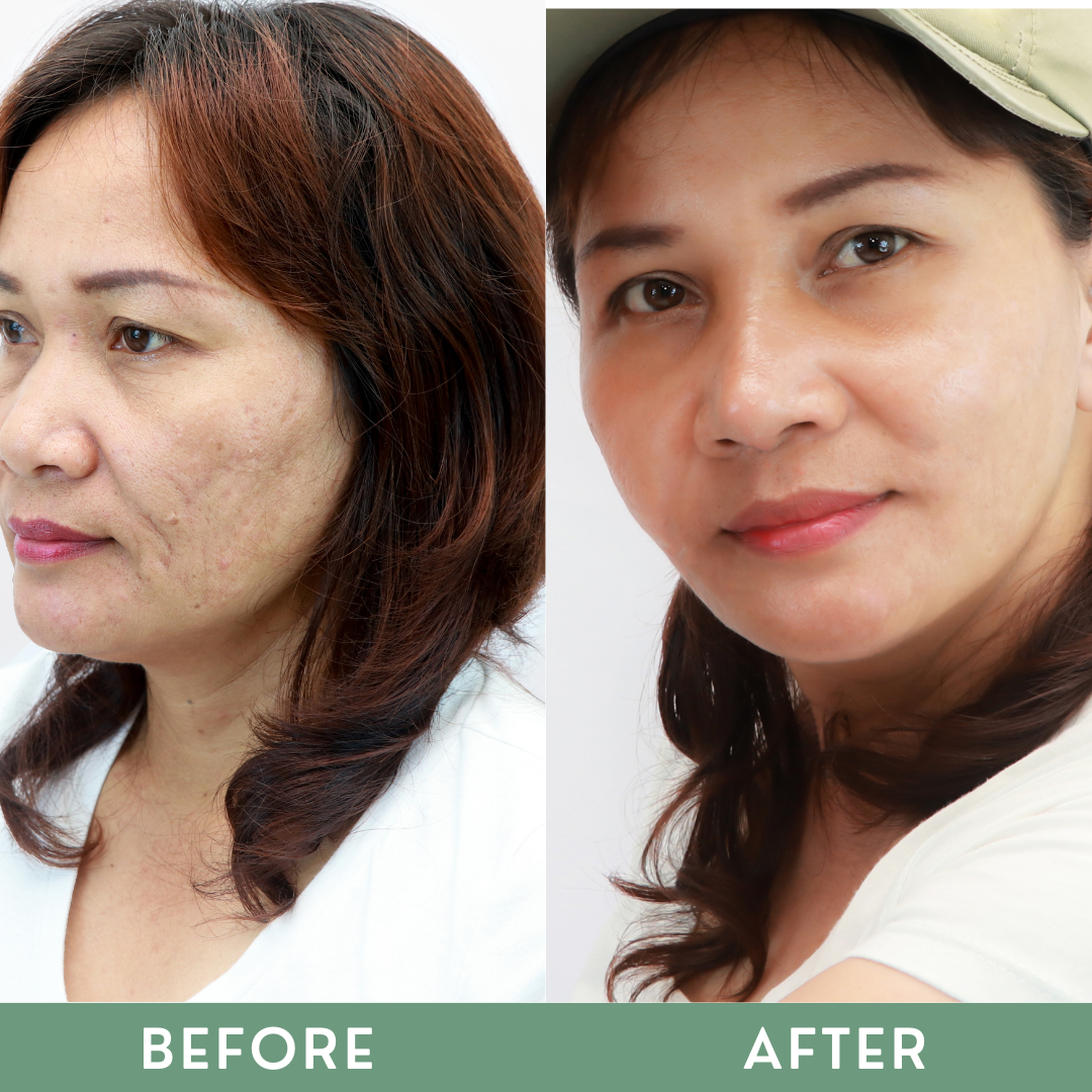 Greenika Collagen Booster Set