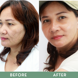 Greenika Collagen Booster Set