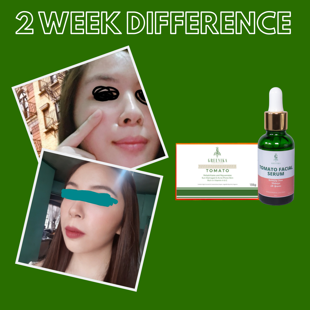 Greenika Tomato Combo Clarifying Tomato Soap and Serum