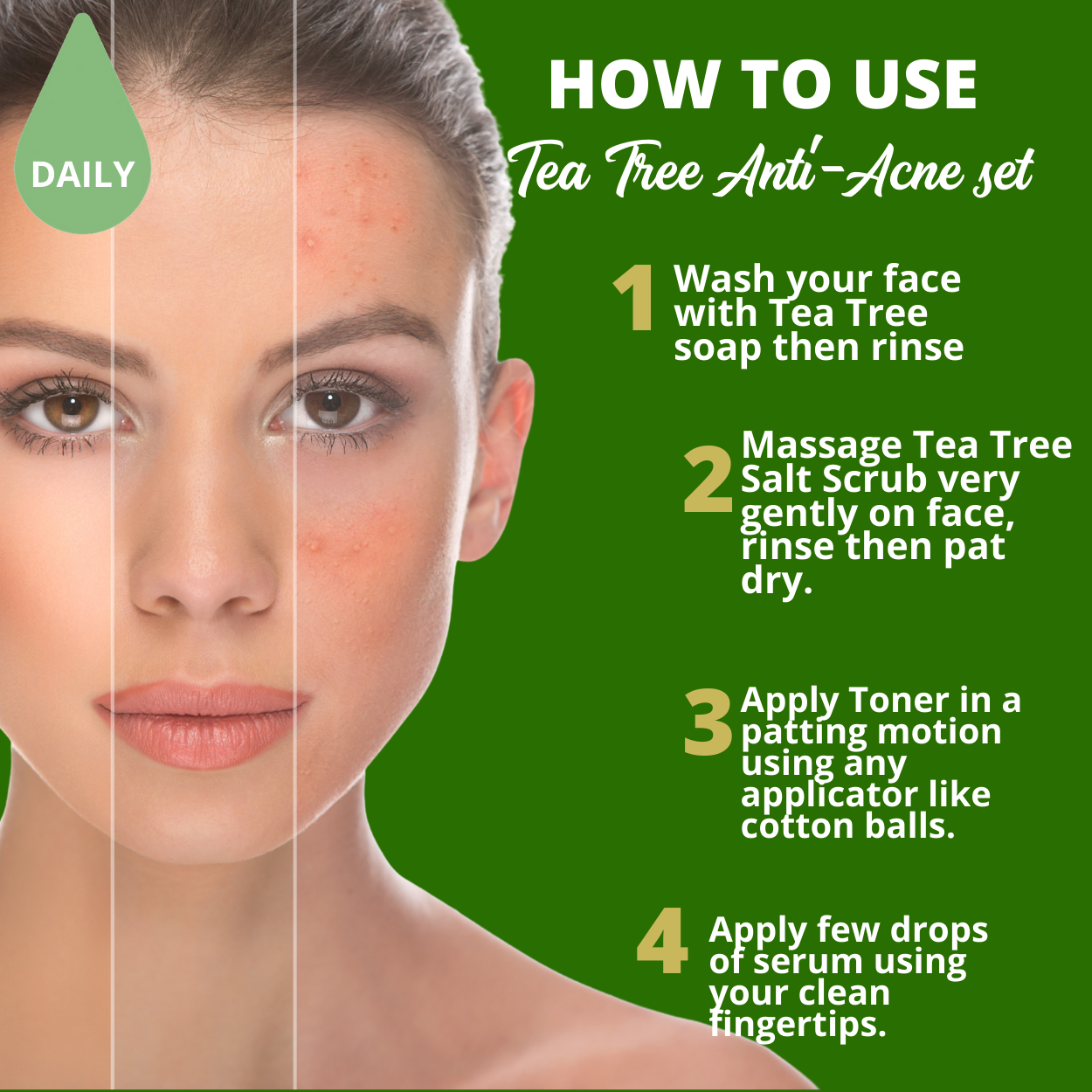 Greenika Tea Tree 4 Pc Anti Acne Set