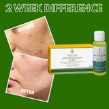 Greenika AHA Combo Face Whitening Serum & AHA Soap Set