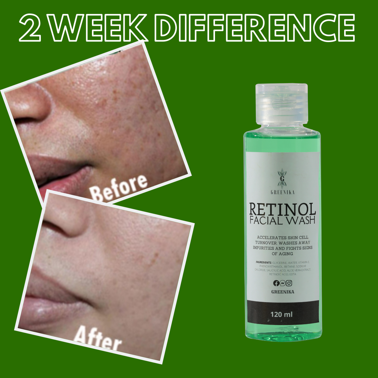 Greenika Retinol Facial Wash