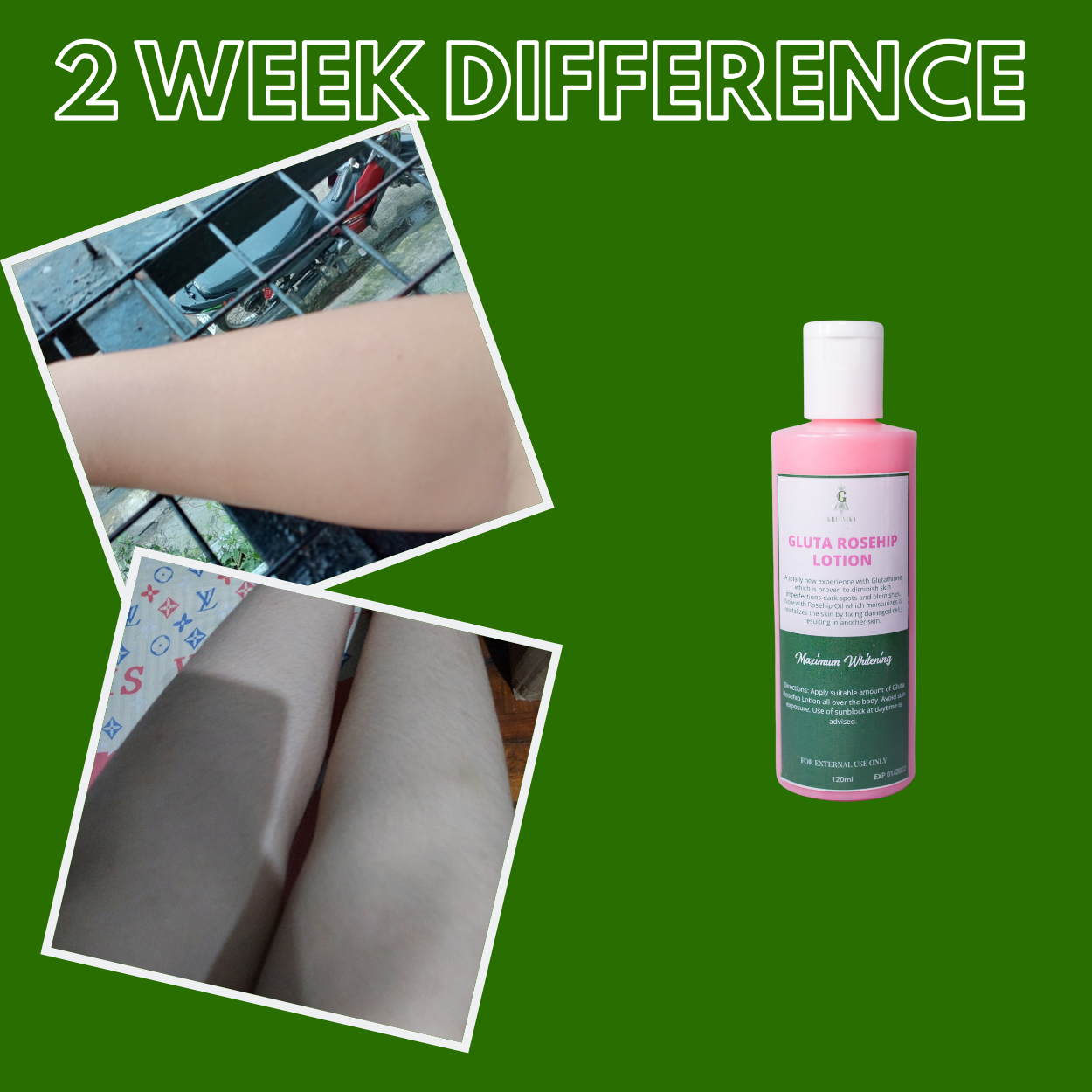 Greenika Glutathione & Rosehip Moisturizing Whitening Lotion