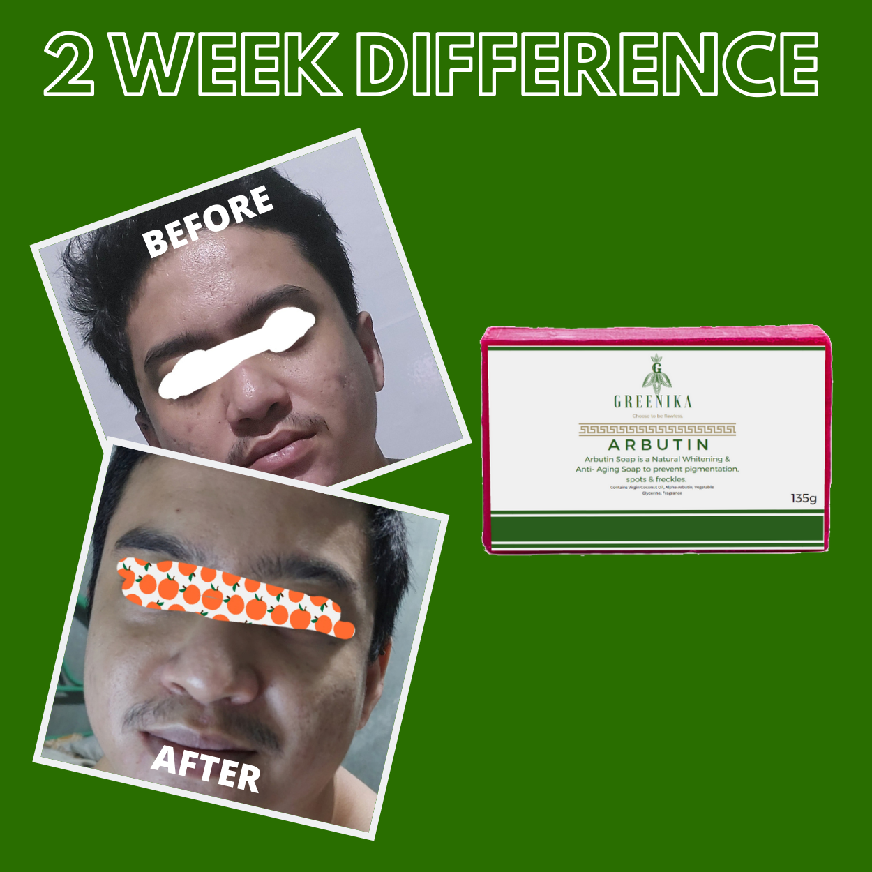 Greenika Premium Organic Alpha Arbutin Soap