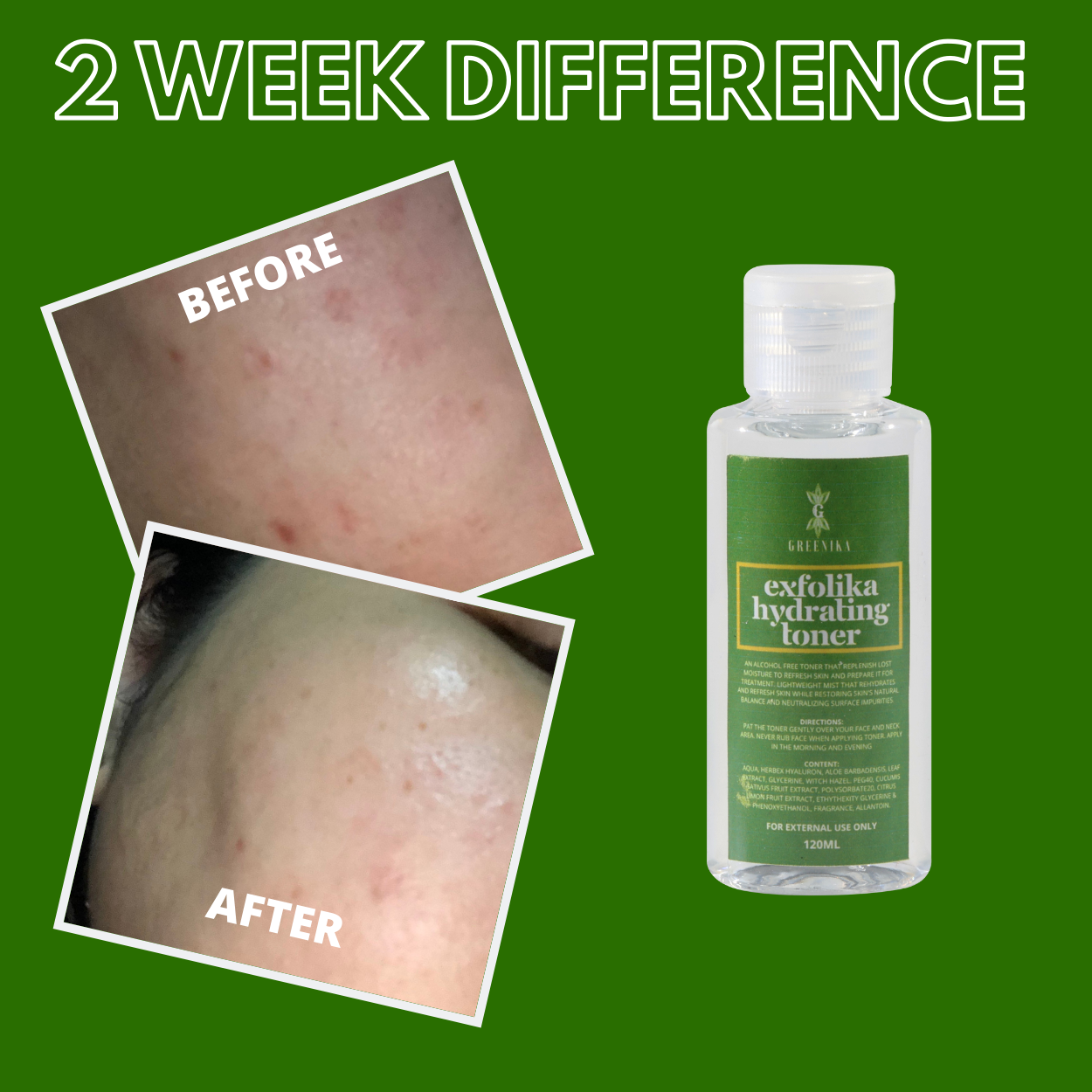 Greenika Exfolika Hydrating Toner