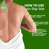 Greenika Body Acne Healing Body Cleanser