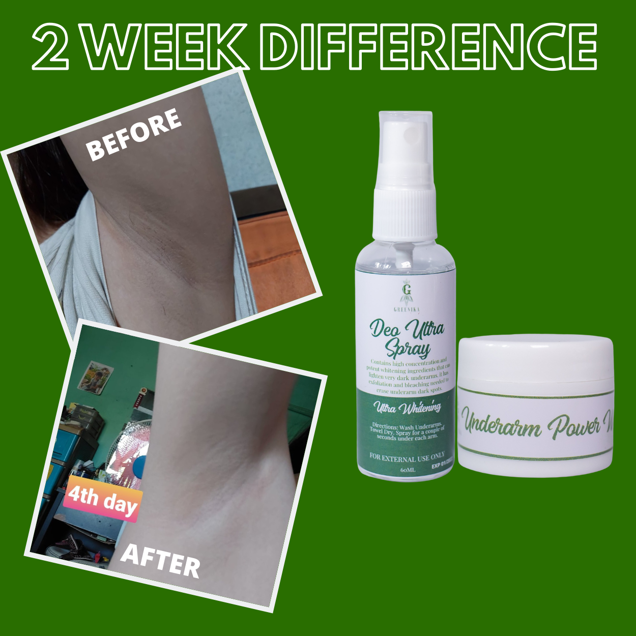 Greenika Whitening Underarm Combo - Cream + Spray