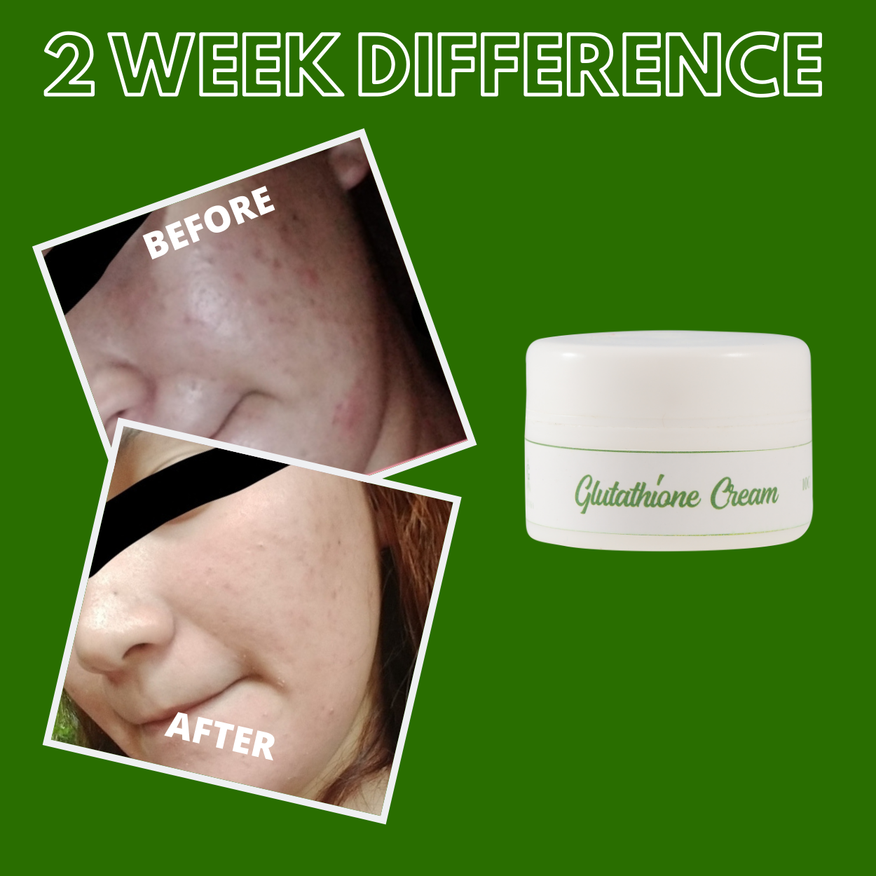 Greenika Glutathione Anti Aging Whitening Cream