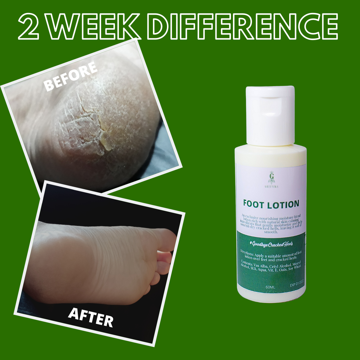 Greenika Natural Foot Cream Lotion
