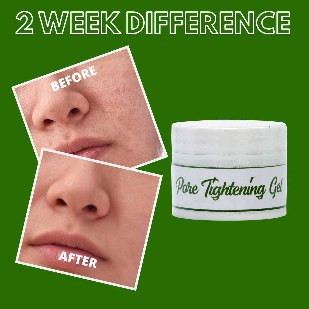 Greenika Pore Tightening Minimizer Gel Facial Moisturizer