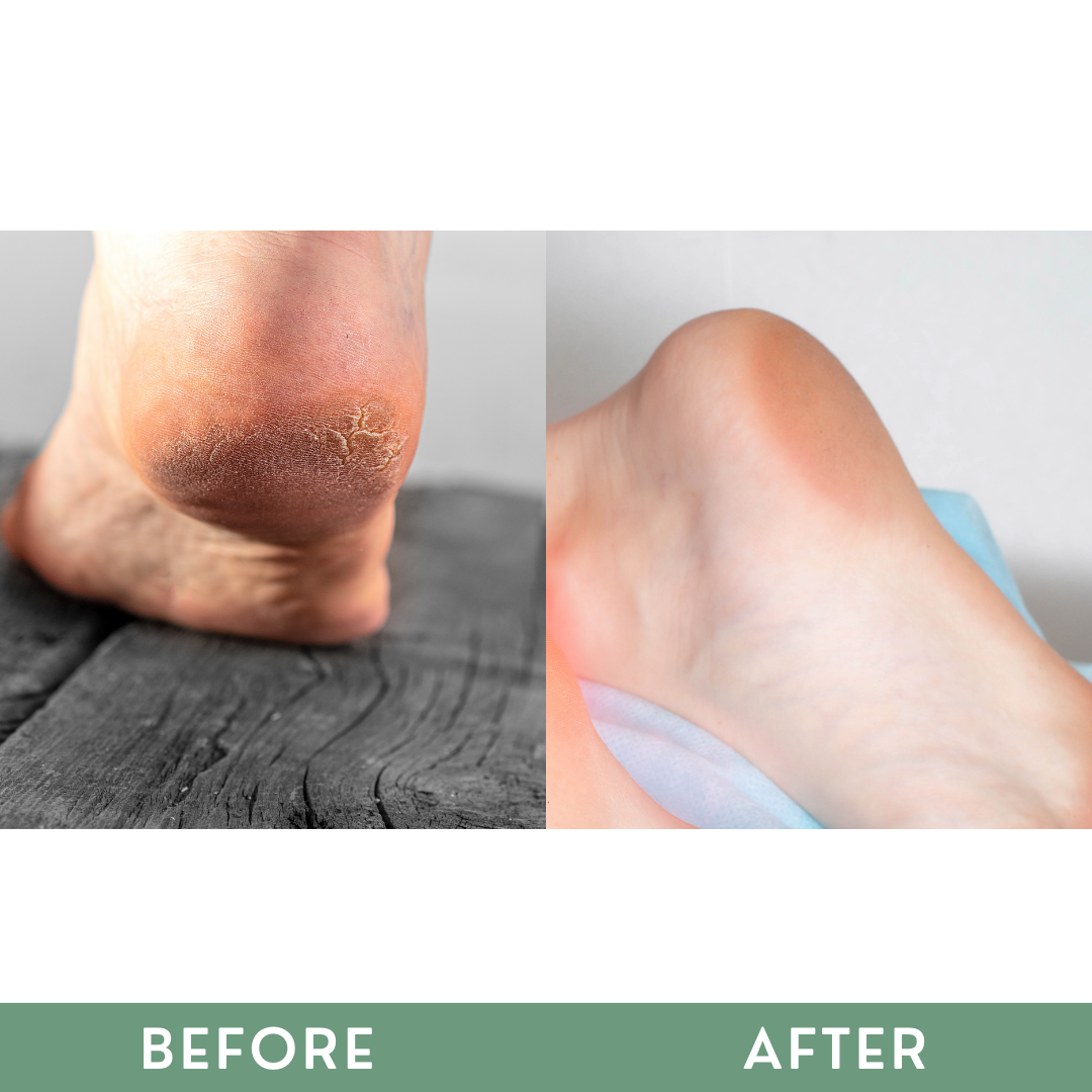 Greenika Therafeet Foot Repair Cream