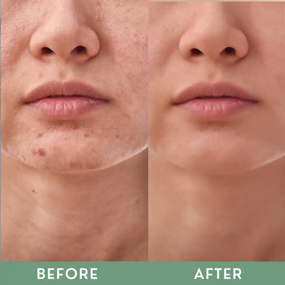 Greenika Vitamin ACE Serum