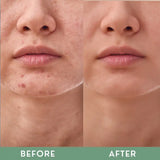 Greenika Vitamin ACE Serum