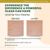 Greenika for Men Nia-X Facial Wash