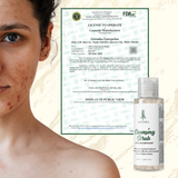 Greenika Anti Acne Black Heads Remover Cleansing Facial Scrub