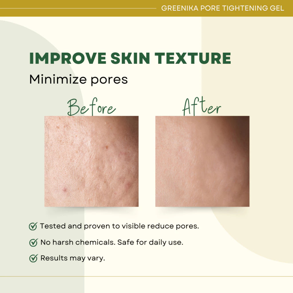 Greenika Pore Tightening Minimizer Gel Facial Moisturizer