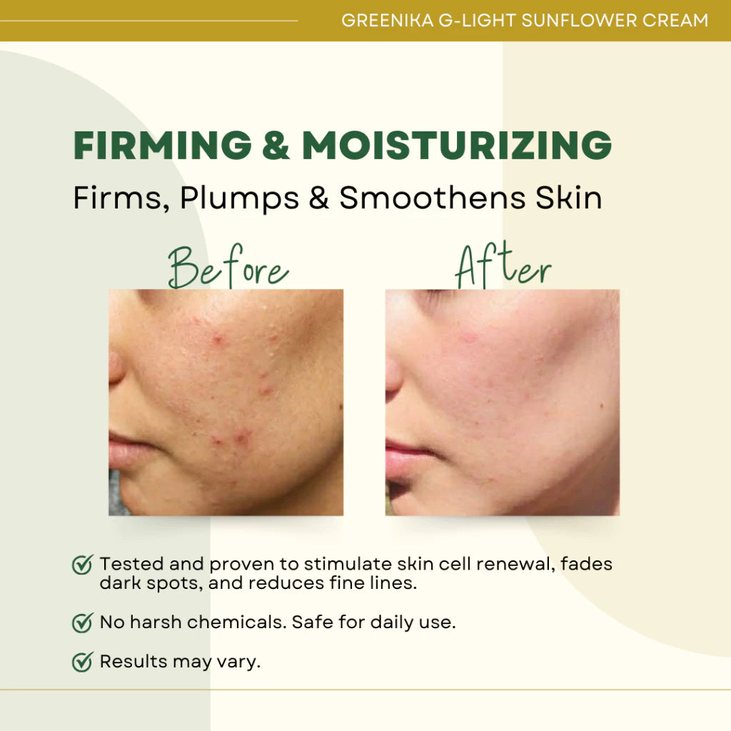 [ ANTI-FRECKLE CREAM ] Greenika G-Light Sunflower Cream