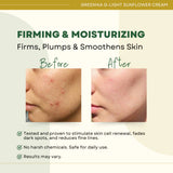 [ ANTI-FRECKLE CREAM ] Greenika G-Light Sunflower Cream