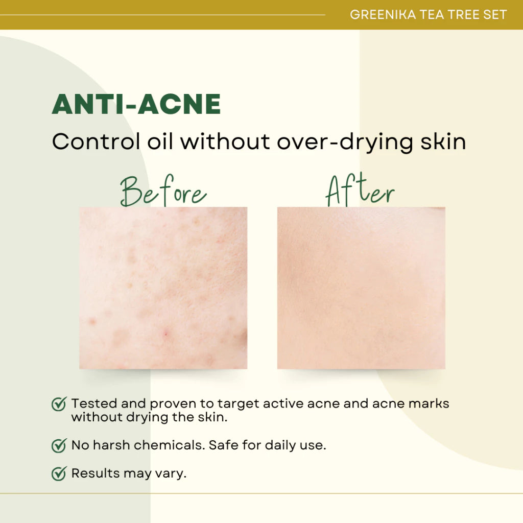 Greenika Tea Tree 4 Pc Anti Acne Set