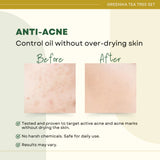 Greenika Tea Tree 4 Pc Anti Acne Set