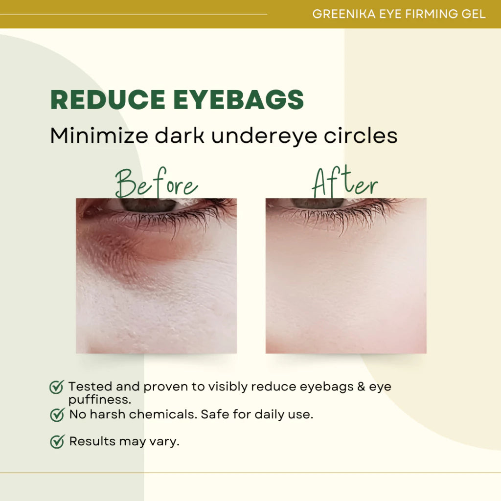 Greenika Eye Firming Gel