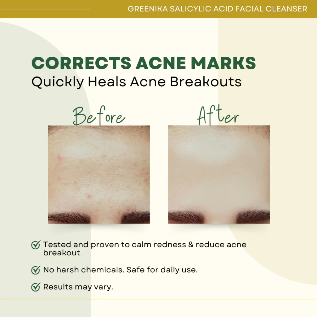 Greenika Salicylic Acid Facial Cleanser