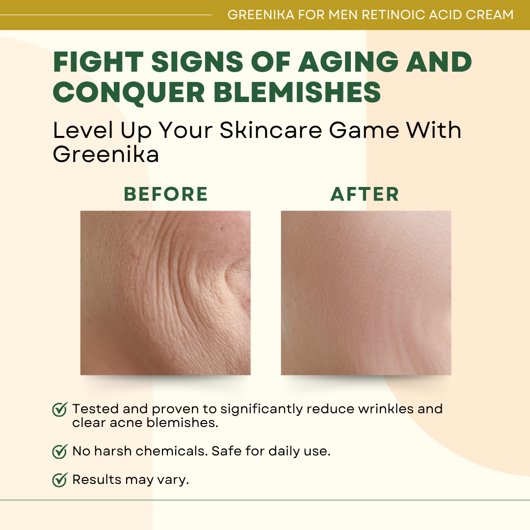 Greenika for Men Retinoic Acid Cream