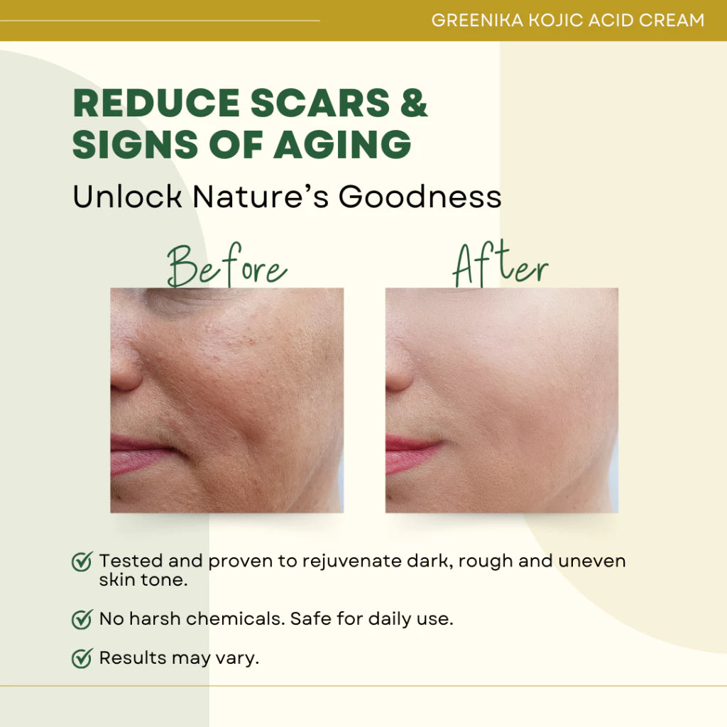 Greenika Kojic Acid Whitening Cream