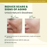 Greenika Kojic Acid Whitening Cream