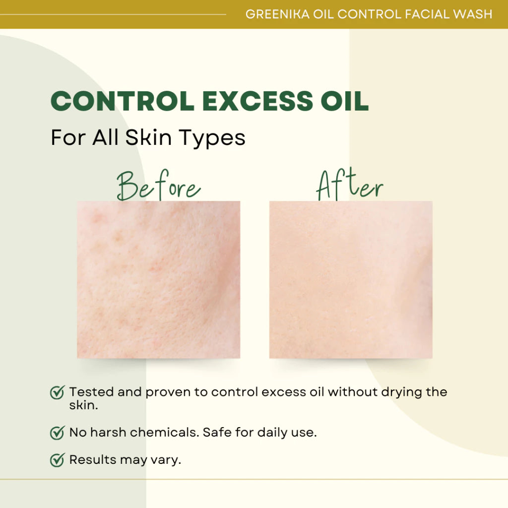 Greenika Oil Control Facial Wash