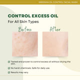 Greenika Oil Control Facial Wash