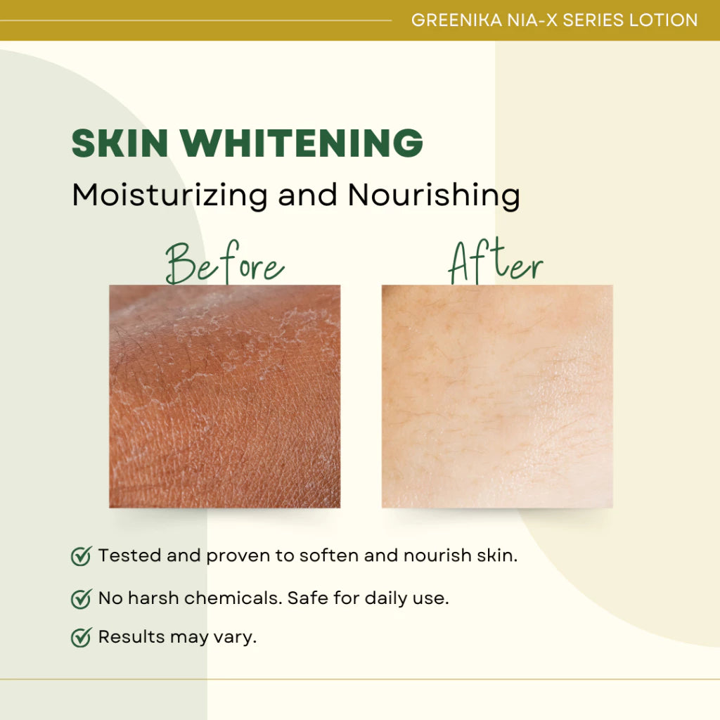 Greenika Nia-X Lotion