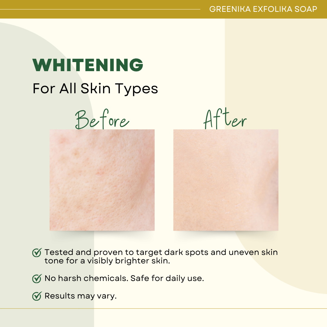 Greenika Exfolika Soap Lightens and Whitens Skin
