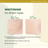 Greenika Exfolika Soap Lightens and Whitens Skin