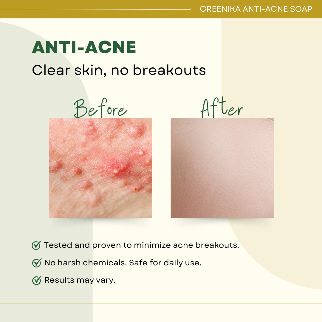 Greenika Anti-Acne Soap