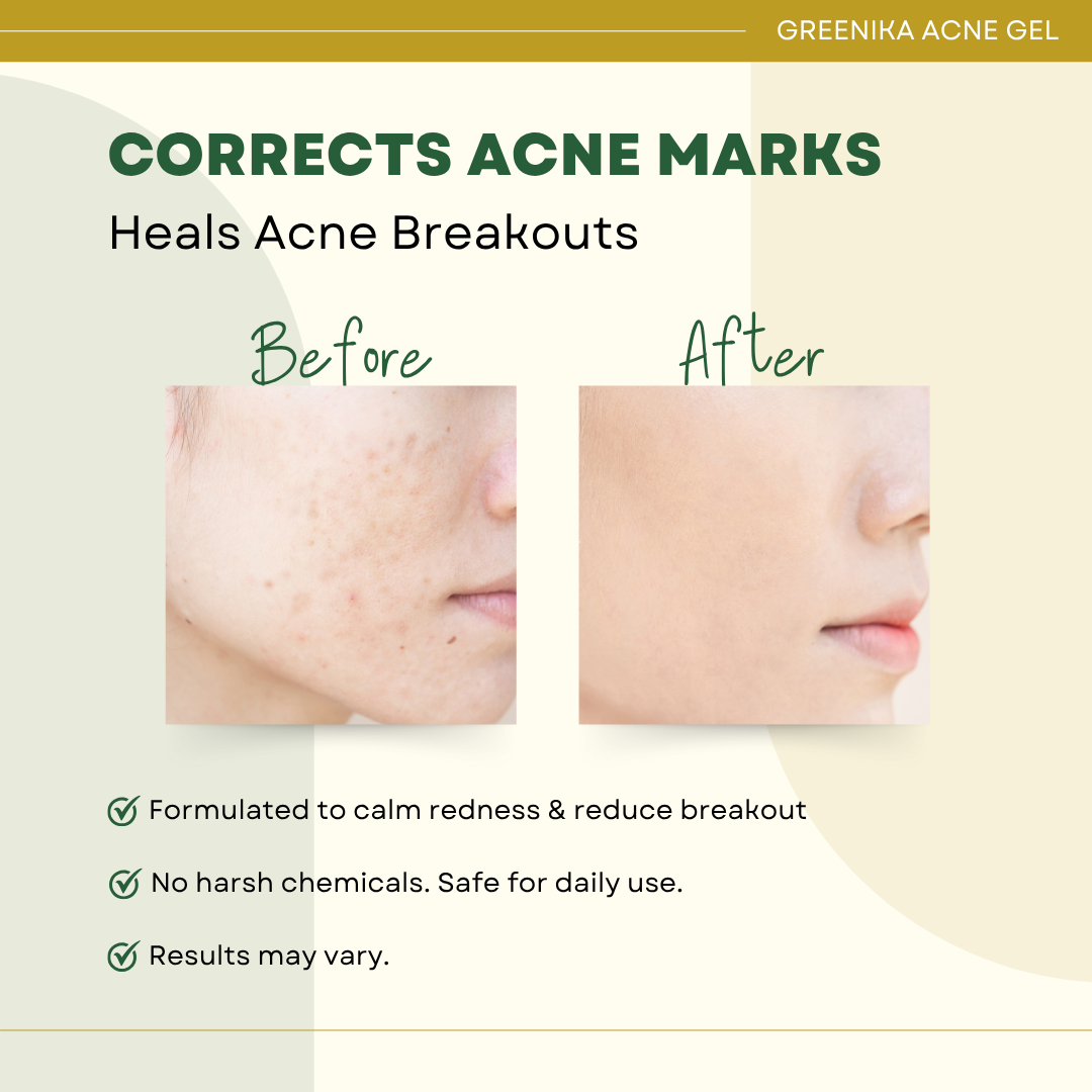 Greenika Acne Plus Gel