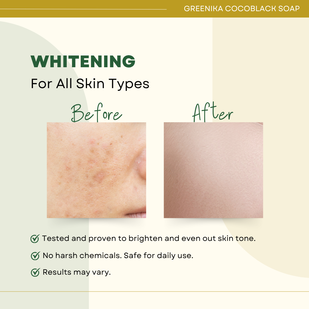 Greenika Ultimate Whitening 10X Bleaching Coco-Black Soap